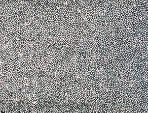 %_tempFileNamelinsen_bw%