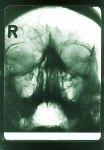 %_tempFileNameschaedel%20R%